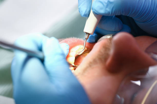 Best Broken or Chipped Tooth Repair in Tutwiler, MS